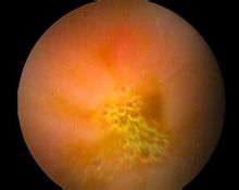 胃神经官能症(图3) 胃神经官能症(图3)